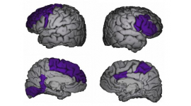 FIDMAG participa en un estudio que muestra la presencia de cambios cerebrales en pacientes con trastorno bipolar a lo largo del tiempo