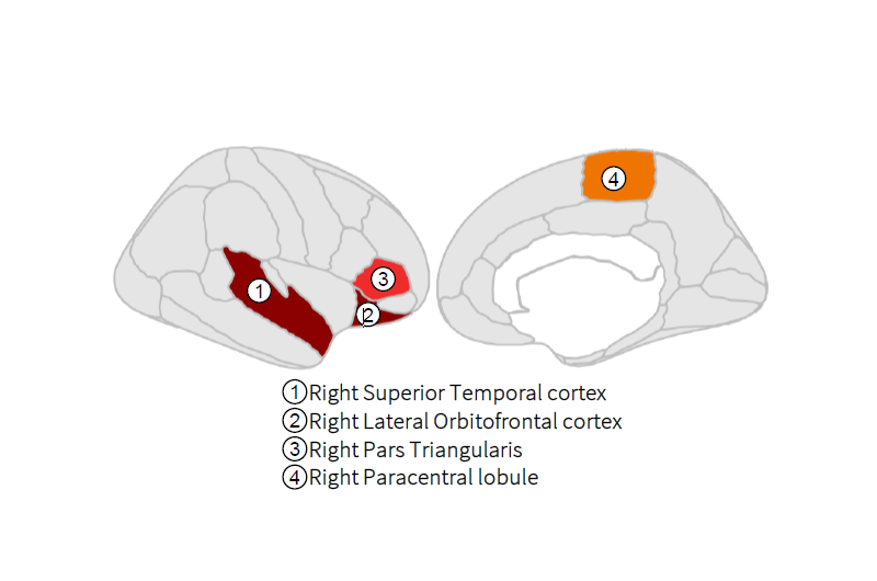 Publicado un estudio sobre la influencia de marcadores genéticos evolutivos relacionados con el neurodesarrollo fetal en la esquizofrenia